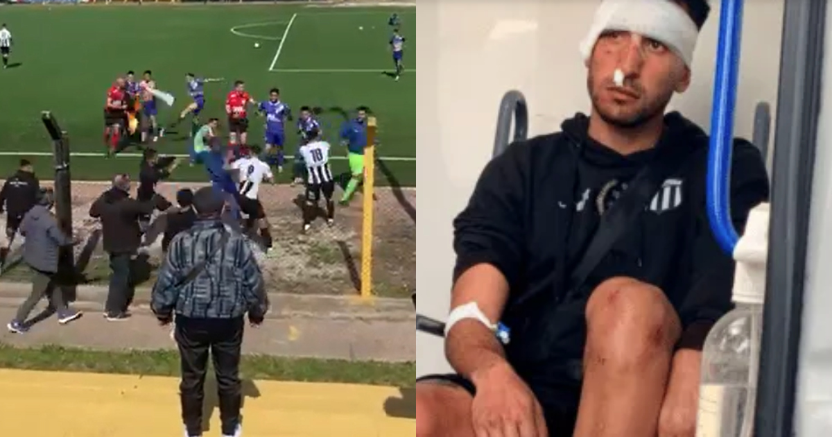 Σπάνια σκηνικά με ξύλο στην Ουρουγουάη, πρωτόγνωρα πράγματα υποστηρίζουν οι τοπικοί φορείς (vid)